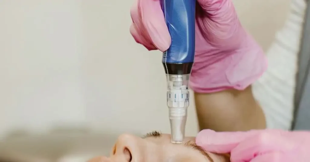 woman in pink gloves giving microneedling treatment