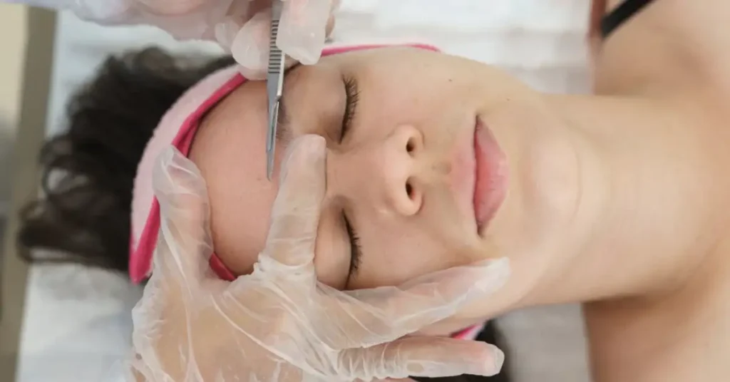 young woman dermaplaning forehead