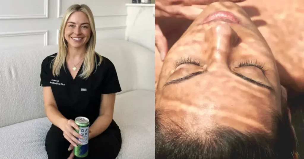 skincare expert telling how to perform Hydrafacial At Home