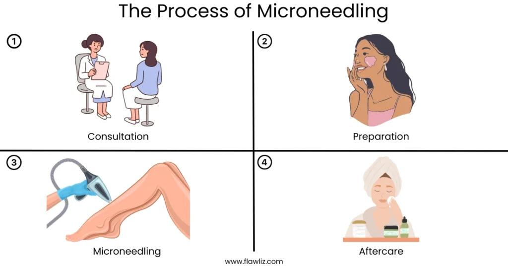 Illustration of The Process of Microneedling