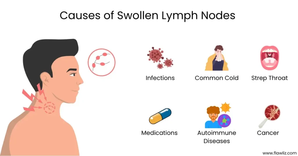 Causes of Swollen Lymph Nodes