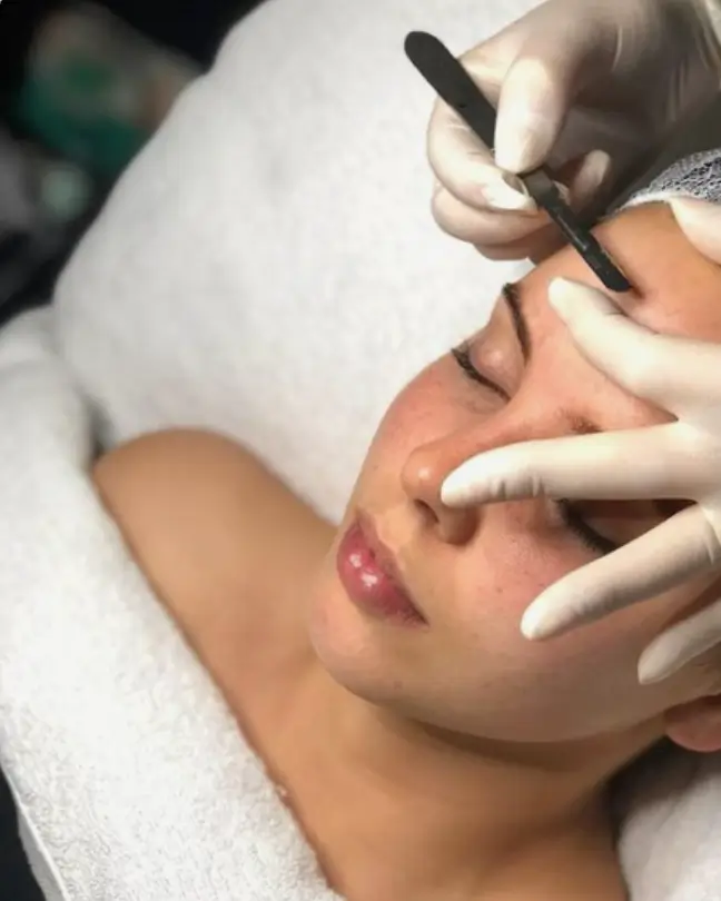 young woman dermaplaning session