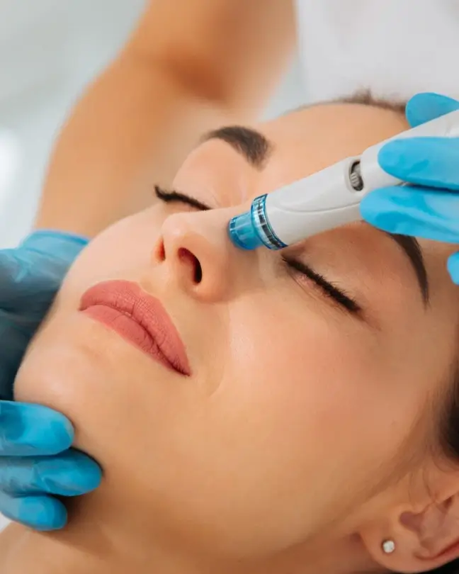 Woman getting hydrafacial on her nose