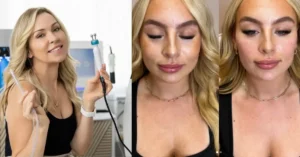 Blonde woman holding hydrofacial device