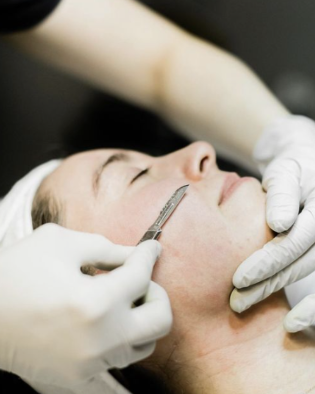 dermaplaning on a womans cheek