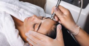 young brown haired woman getting microdermabrasion