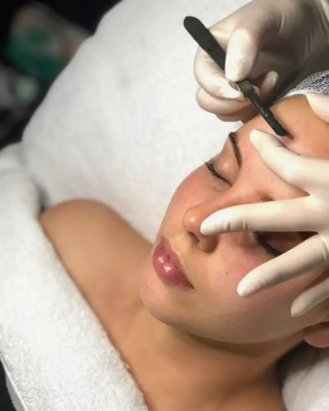 woman getting dermaplaning on her forehead