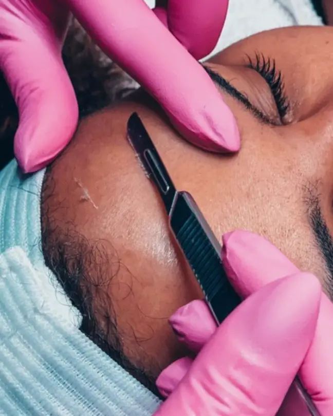 black woman getting dermaplaning on her forehead